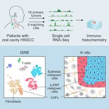 It usually presents itself in an advanced stage and. Single Cell Transcriptomic Analysis Of Primary And Metastatic Tumor Ecosystems In Head And Neck Cancer Sciencedirect