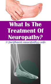 Pin On Auditory Neuropathy