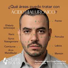 Dr. Luis Solís (@cirugiafacialcuu) · Instagram 照片和视频