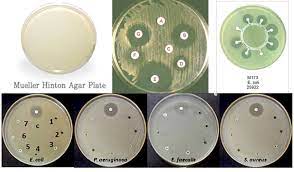 Mueller hinton e agar 90 mm; Mueller Hinton Agar Mha Composition Principle Uses And Preparation