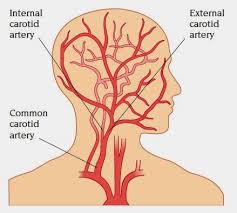 Headaches and dizziness online course: How Many Carotid Arteries In The Neck Pictures Of Carotid Arteries It Supplies Structures Present In The Cranial Cavity And Orbit Dilnameiry