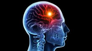 In general, healthy lifestyle recommendations include: Strokes Keiro