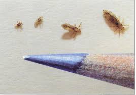 How does a lice egg look like? How To Identify Lice Nits Lice Eggs Lice Charmers