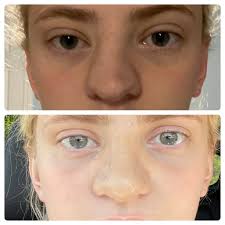 The New Knife-style: Why More Young Women Are Getting Cosmetic Surgery