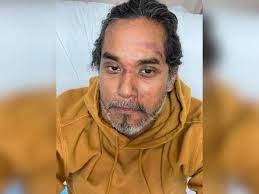 Khairy jamaluddin abu bakar is a malaysian politician. Khairy Cedera Langgar Lubang Ketika Berbasikal