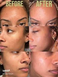 57 top Exfoliating with Activated Charcoal ideas in 2025