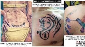 Best tattoo removal creams : Tattoo Remoov Lebanon Posts Facebook