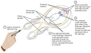 Pupillary Light Reflex Afferent 2nd N Efferent 3rd N