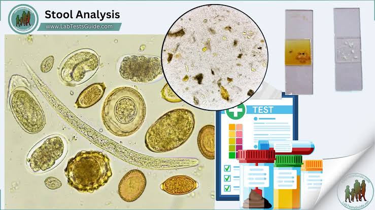 Stool Analysis: Diagnostic Protocols for Gastrointestinal Disorders