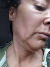 They treat you like family, not a client. Krave Medical Aesthetics 3305 W 144th Ave Ste 202 Broomfield Co Medical Spas Mapquest