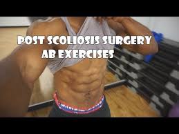 ab exercises for people with scoliosis
