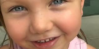 Potret Mata Biru Anak-Anak Marissa Nasution Padahal Orangtua Bermata  Coklat, Dijelaskan Penyebabnya