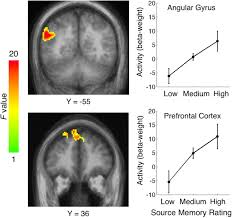 Medial Temporal Lobe Function and Recognition Memory: A Novel Approach to  Separating the Contribution of Recollection and Familiarity | Journal of  Neuroscience