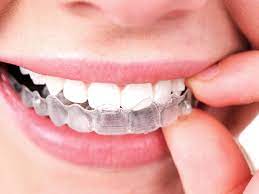 Some minor cases of crowding can be corrected in as few as six months, while moderate cases will take closer to a year. How Long Before My Invisalign Starts Showing Results Dental Health Society