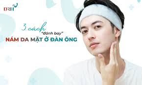 3 cách “đánh bay” nám da mặt ở đàn ông lấy lại phong độ