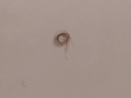Pearly penile papules (ppps) are tiny lumps seen in neat rows around the corona of the glans penis ( figure 1 ). Had A Blackhead On My Penis For A Few Years And I Just Popped It Today It Was A Rolled Up Ingrown Hair Imgur