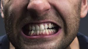 Grinding Your Teeth Relax There Are Solutions