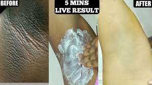 Grate a potato, squeeze the juice from the grated potato, and apply the juice to your underarms. In 5 Minutes Lighten Dark Underarms Naturally And Permanently Youtube