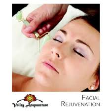VALLEY ACUPUNCTURE