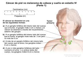 El melanoma puede afectar a personas de cualquier tono de piel y sus signos y síntomas incluyen: Tratamiento Del Cancer De Piel Pdq Version Para Pacientes Instituto Nacional Del Cancer