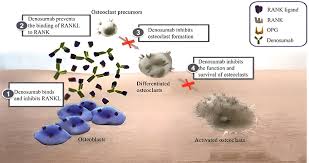Image result for Denosumab