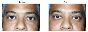 Image result for Blepharis transvaalensis