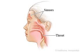 We did not find results for: Upper Respiratory Infection Cold In Children 3 Months To 1 Year Care Instructions