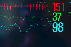 Svt:s nyhetstjänst med nyheter från hela sverige och världen inom kultur, sport, opinion och väder. Types Of Supraventricular Tachycardia Svt