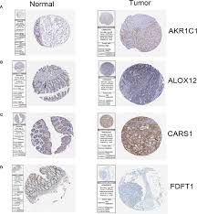 Image result for Ptycholobium contortum