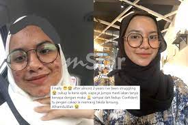 Diterbitkan pada juli 3, 2020 ditulis oleh : Muka Anak Disamakan Macam Bulan Ibu Yang Rasa Sakit Nekad Bawa Gadis Ini Jumpa Pakar Kali Pertama Rawatan Mereka Picit Jerawat Saya Viral Mstar