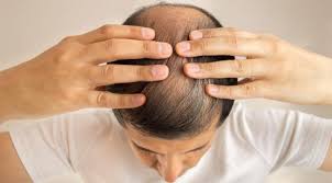 They approach the same problem but in totally different ways. Caffeine Shampoo Firm Banned From Promoting Anti Hair Loss Product Heraldscotland