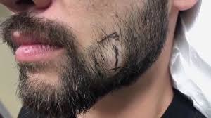 But popping pimples isn't always bad — you just need to know what to pop and how to do it. Dr Pimple Popper The Biggest And Craziest Pop Of 2019