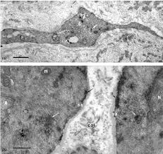 Smooth muscle fiber is found lining hollow organs throughout the body and generally contracts and relaxes involuntarily — unlike skeletal muscle. A B Electron Microscopy Of Vascular Smooth Muscle Cells Of Capybara Download Scientific Diagram