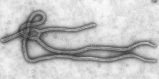 Both viruses are native to africa,. Simplyscience Das Ebolavirus