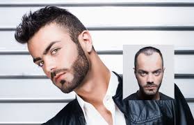 We all have our own clientele, so we are not threatened by other stylists being here. Hair Replacement Hair Loss Restoration Specialists Tupelo Mississippi