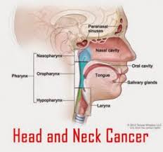 If you have any symptoms of throat cancer, be sure to call the ent for an assessment right away. Mouth Head And Neck Cancer Marie Keating Foundation