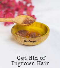 Treatment options for ingrown hair cyst ranges from medical treatments (corticosteroids, antibiotics, pain killers, cryoablation, epilation, laser removal, surgery, etc. Diy Beauty Mask For Ingrown Hair Treatment