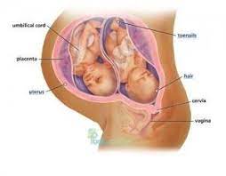 Tingkat hormon estrogen memengaruhi sense of taste di. Kelab Ibu Hamil Dan Menyusu Bayi Tanda2 Kehamilan Kembar Anda Bertanya Tanya Tentang Tanda Tanda Kehamilan Kembar Hampir Setiap Ibu Hamil Di Dunia Terlintas Dalam Pikiran Mereka Bahwa Mungkin Ada Bayi Kembar Di