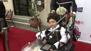 Amyotrophic lateral sclerosis, or als, is a progressive neurodegenerative disease. Pasadena Benefit Honors People Living With Als Documentaries On Disease Abc7 Los Angeles