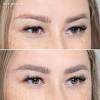 Thanks to a bonding agent that is applied to the open skin, the ink is drawn to the skin's surface. 3