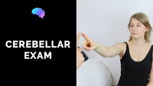 Image result for Cerebellar Function Test