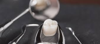 Tak terkecuali saat puasa tiba. Mencabut Gigi Saat Puasa Apakah Puasa Batal Bincang Syariah