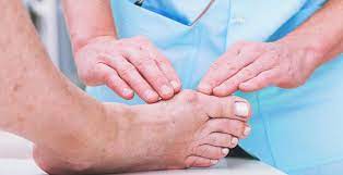 How To Get Rid Of A Bunion Get Rid Of Bunions Bunion Remedies How To Treat Bunions