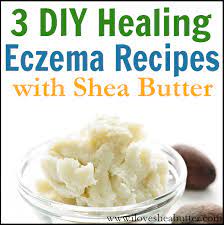 Homemade body butter is an easy diy project for anyone. 3 Diy Shea Butter Recipes For Eczema Beautymunsta Free Natural Beauty Hacks And More