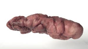 Fournier's gangrene is rapidly progressive necrotizing fasciitis that mainly affects the male perineum. Artstation Lookdev Organic Stuffs Substance Designer Arnaud Fournier
