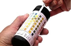 Urinalysis For Dummies Medical Laboratory Nursing Assessment Health