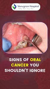 Image result for gum cancer symptoms