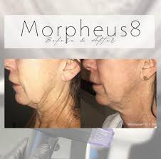 Sherry Minnella Aesthetic Nurse Practitioner