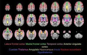 We did not find results for: Neurobiological Basis Of Hypersexuality Sciencedirect