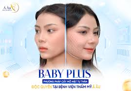 Phương pháp cấy mỡ mặt tự thân Baby Plus độc quyền BVTM Á Âu